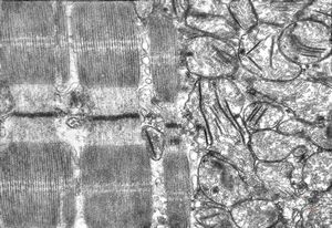 rat | skeletal muscle 6h. post ex. … changes of mitochondrial cristae rat | skeletal muscle 6h. post ex. … changes of mitochondrial cristae